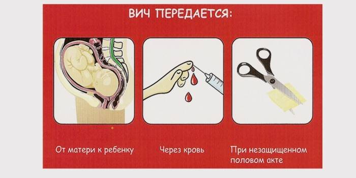 Jak przenosi się HIV?