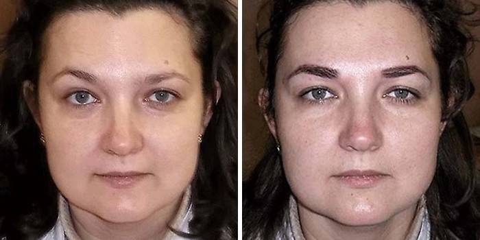 Rosto antes e depois