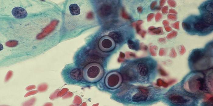 Pasożyty chlamydia trachomatis