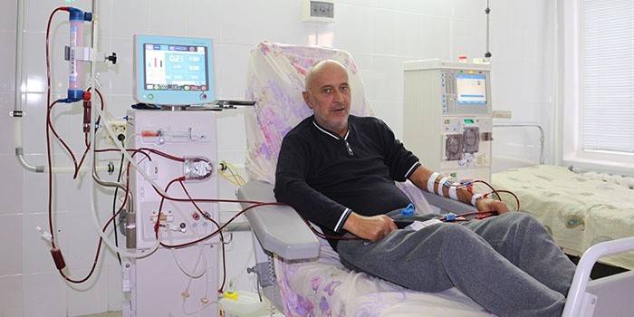 Diuréza a komplikácie horúčky myši