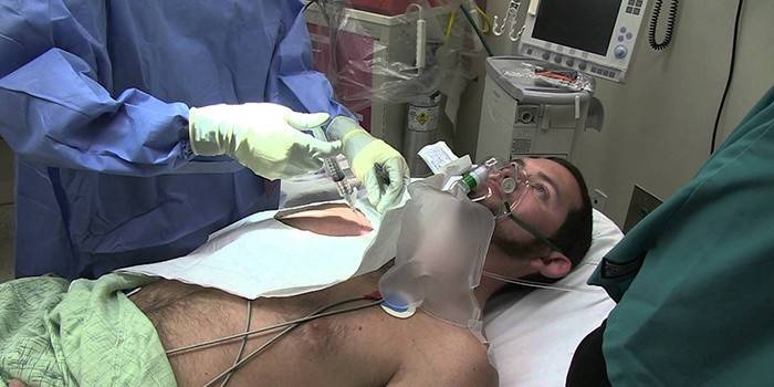 Pneumotórax para tuberculose pulmonar