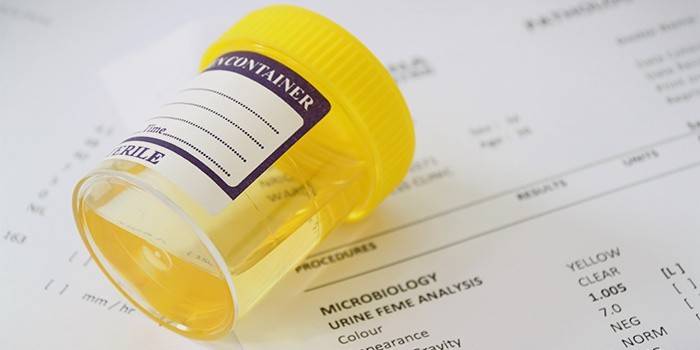 Análisis de orina para pielonefritis