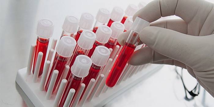 Laboratórny technik vykonáva krvné testy krvných doštičiek
