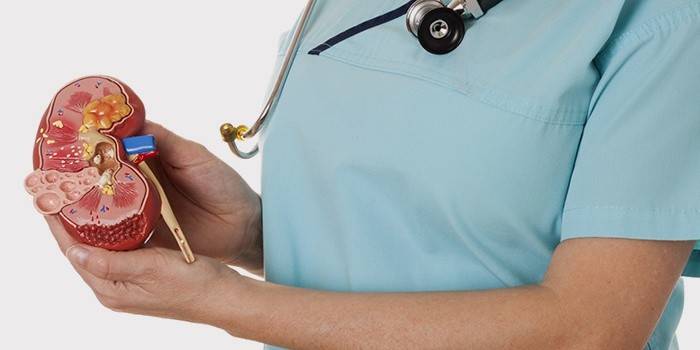 ¿Cómo se ve la insuficiencia renal?