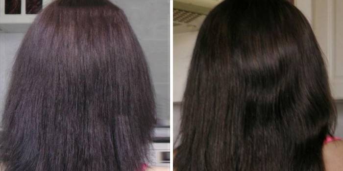 Cabelo antes e depois do darsonvalization