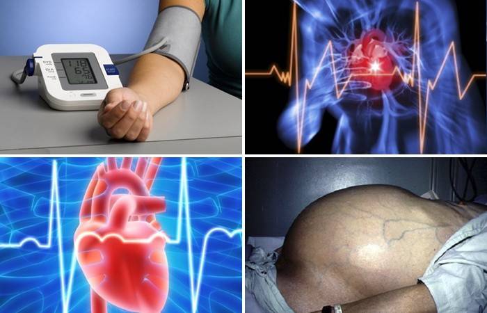Indikácie pre použitie Asparkam