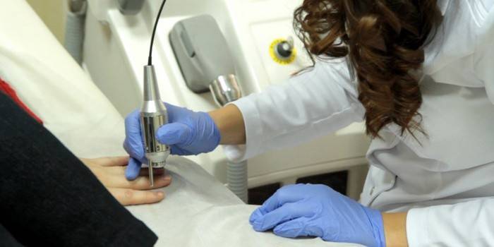 Tratamento de fungos a laser