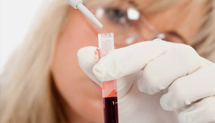 Analýza laboratórneho asistenta