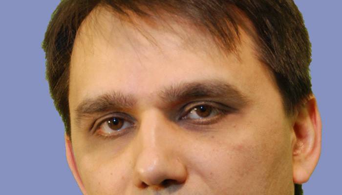 Moretones y bolsas debajo de los ojos de un hombre