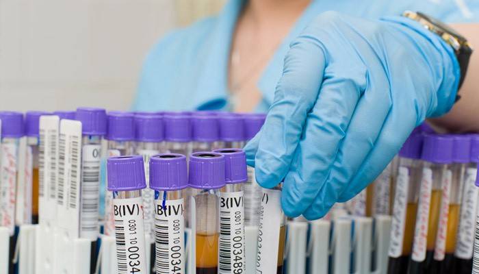 Technik laboratoryjny wyjmuje probówkę