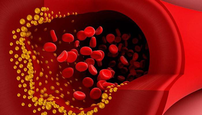 Placas de colesterol no sangue