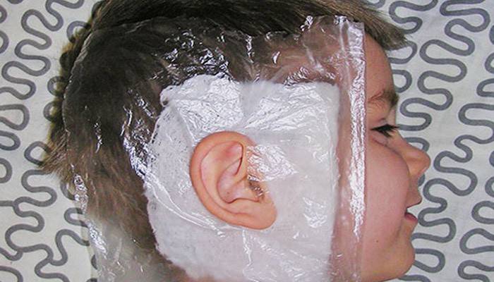 Un niño con una venda tibia con Dimexidum