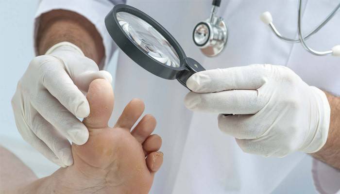 Dermatologista examina o fungo entre os dedos do paciente