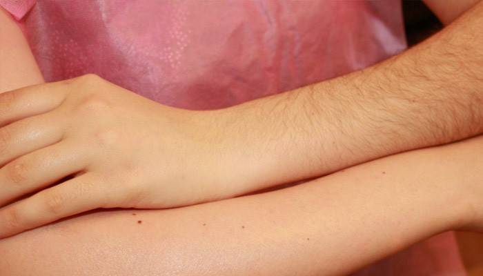 Mãos de uma garota antes e depois da depilação