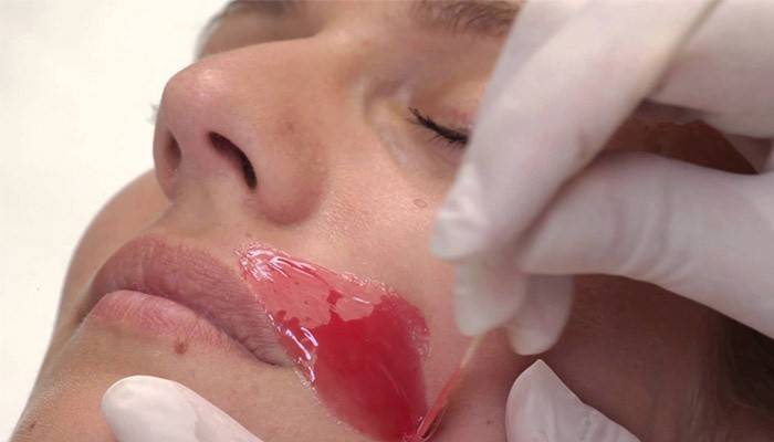 Depilação Facial