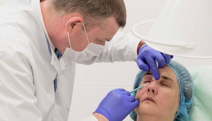 Remoção de toupeira a laser