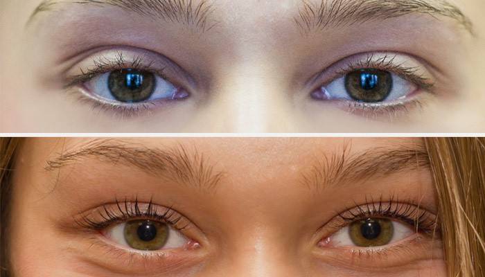 Menina antes e depois da laminação de cílios