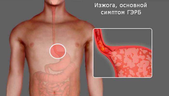 La estructura del tracto gastrointestinal humano y los síntomas de la ERGE