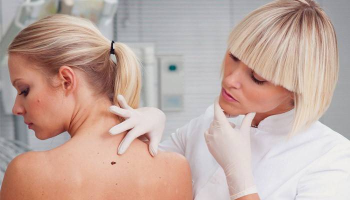 Dermatolog bada brodawczaki na ciele dziewczynki