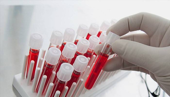 Exames de sangue de ovários multifoliculares