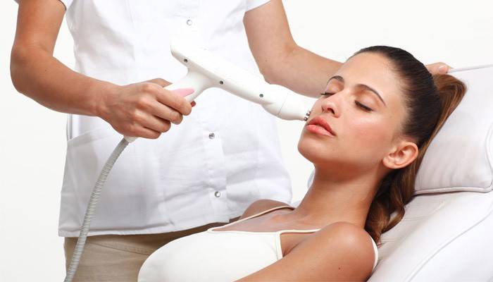 Resurfacing a laser para cicatrizes
