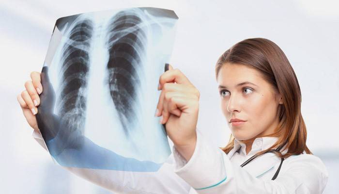 Médico, examina, um, raio x