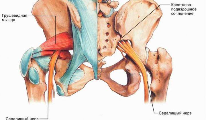 Isquialgia lumbar vertebrogénica