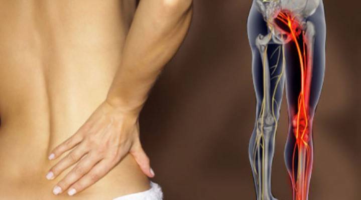 Dolor muscular en la parte baja de la espalda.