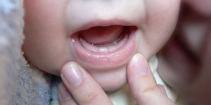 Dentición del primer diente del bebé