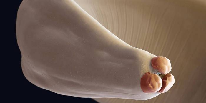 Worm of Ascaris