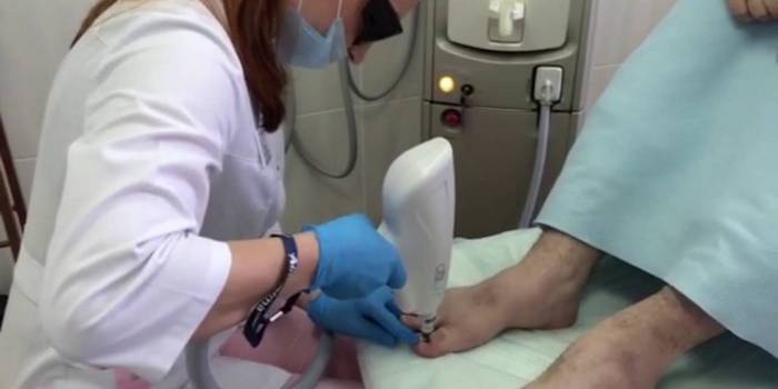 Tratamento a laser