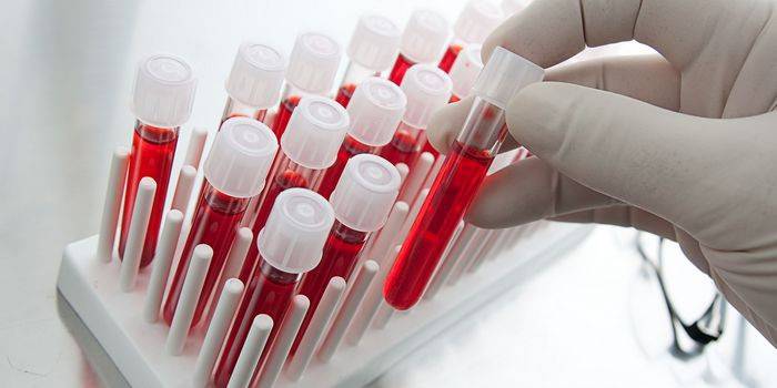 Exame de sangue para parasitas