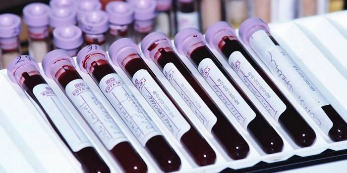 Tubos de sangue para análise