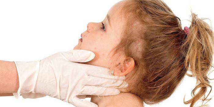 Uma criança com rubéola na consulta de um médico