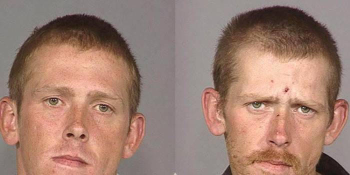 Foto de um homem antes e depois de usar o butirato
