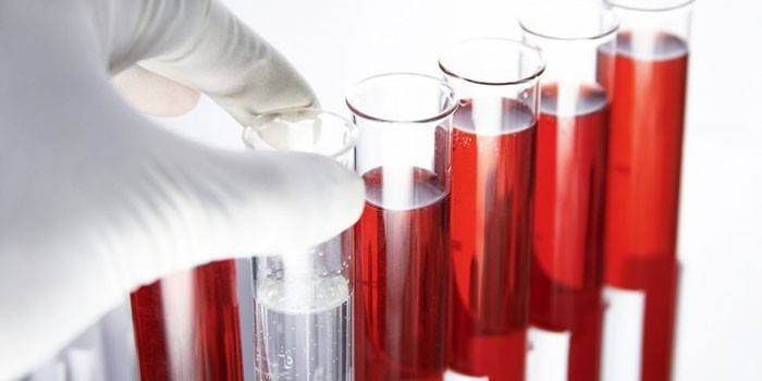 Krvné testy in vitro