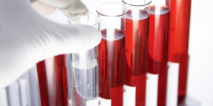 Exame de sangue