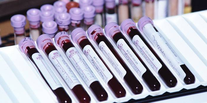 Krvné testy in vitro