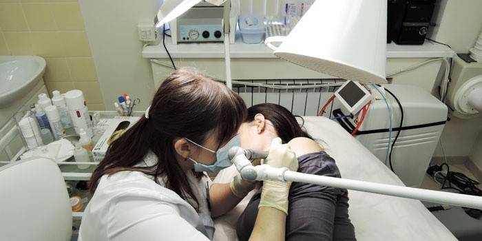 Kosmetyczka wykonuje laserowe usuwanie znamion u pacjenta