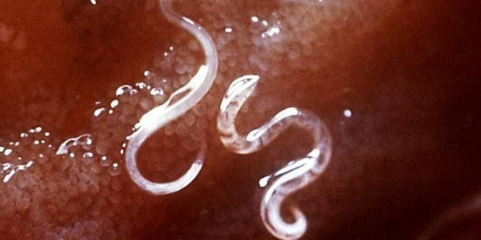 Pinworms no corpo humano