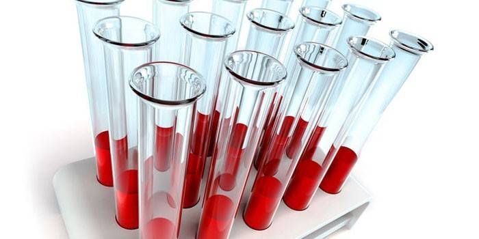 Testes de sangue in vitro