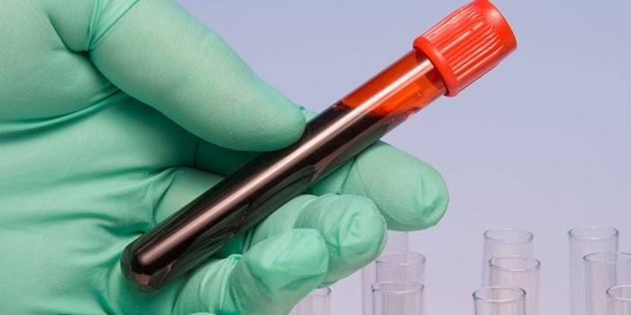 Tubo de ensaio com sangue na mão