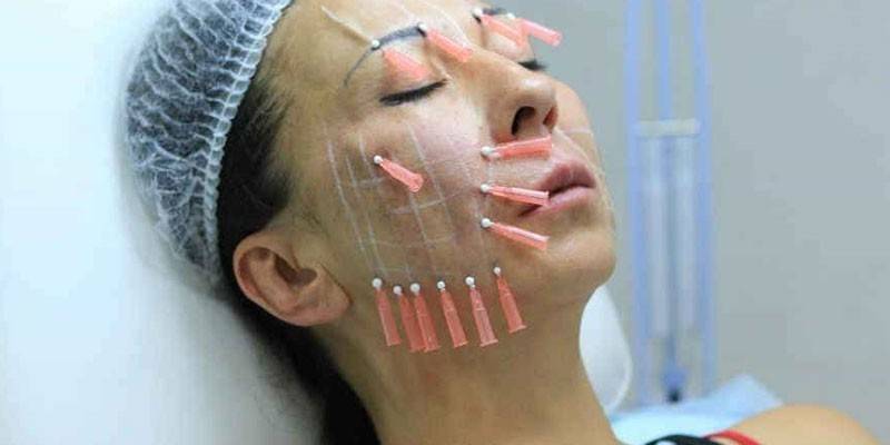 Mezanino de face lift