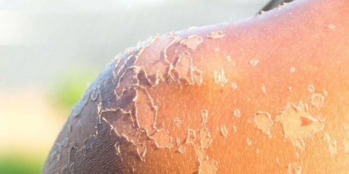 Peeling de pele