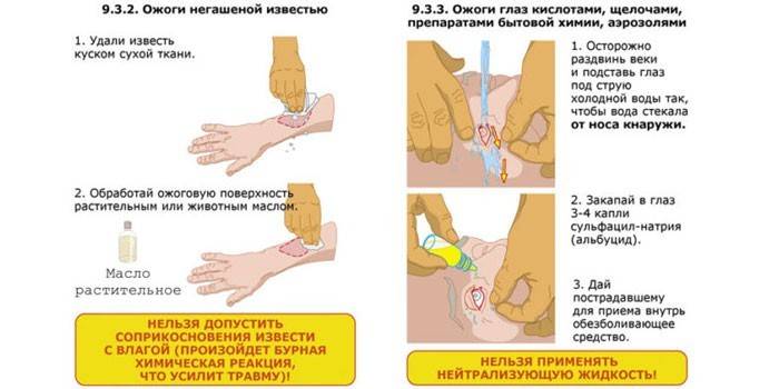 Pierwsza pomoc w oparzeniach chemicznych