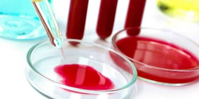 Prueba de sangre