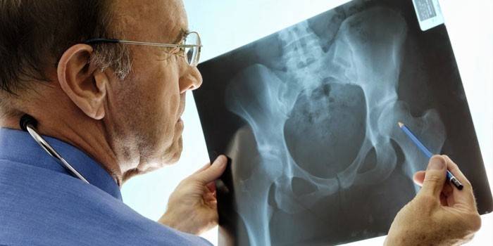 Médico examina una radiografía