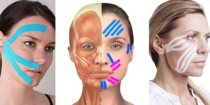 Áreas de vendaje facial