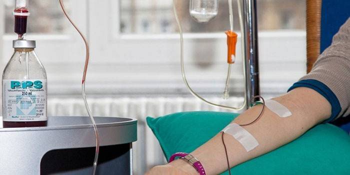 Ozonoterapia intravenosa