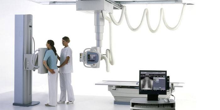 X-ray dievča